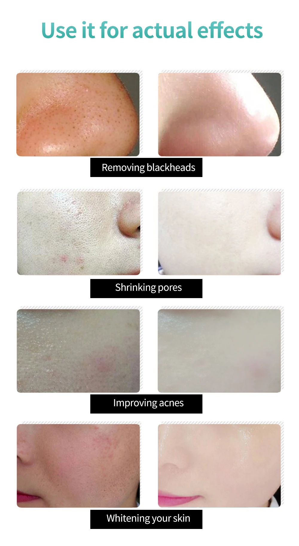 LANBENA قناع أسود مزيل الرؤوس السوداء الأنف قناع أسود العناية بالوجه الطين علاج حب الشباب تقشر قناع المسام قطاع العناية بالبشرة السيطرة على النفط